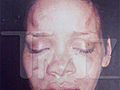 WOW: Shocking Photo Of Rihanna After Chris Brown Incident!