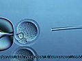 Mouse Egg IVF Video