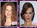 CelebrityFIX Fast Forward: Nicole Kidman