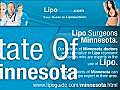 Lipo Minnesota