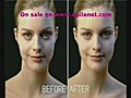 aging wrinklesfacelift UP5 proffessional skincare at home