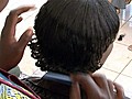 Diabetes and Women’s Hairstyles Linked to Alopecia