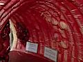 [Video] See what the doctor sees: a tour of a life size colon