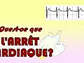 Qu’est-ce que l&#039;arrêt cardiaque