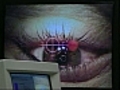 Artificial cornea shows promise in restoring vision