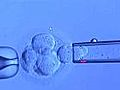 Doctor bucking trend by using one IVF embryo