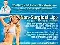 NonSurgical Liposuction Oklahoma