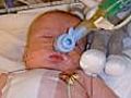 Cling film saves baby