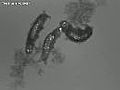 Tardigrade