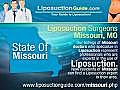 Liposuction Missouri