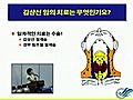 한림대학교의료원 강동성심병원 외과 최수윤 교수 - 갑상선 이야기