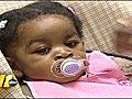 Baby born with rare immune disorder