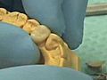 Lecture 19 - Fabricating Provisional Crowns,  Dental Prosthodontics