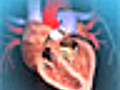Aortic Valve Replacement Animation