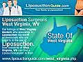 Liposuction West Virginia