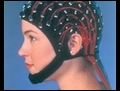 Elektro-Ensefalografi (EEG) nedir?