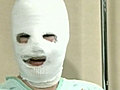 Latest : It was a hoax! : Canada AM: Woman threw acid on her own face