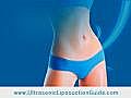 Ultrasonic Liposuction