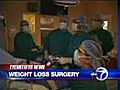 New report on gastric bypass surgery
