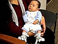 Medical Moments: Clubbed Feet