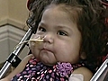 Baby Undergoes Risky 7-Organ Transplant