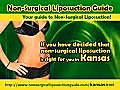 Non Surgical Liposuction Kansas