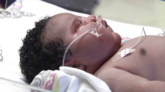 Baby born breaks hospital record