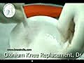 Knee Replacement Surgery Video