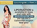 Liposuction Iowa