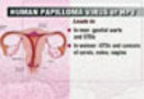 Eight out of ten women in India die of cervical cancer