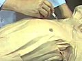Lecture 20 - Anterior Trunk and Shoulder - Subcutaneous,  Human Anatomy Dissection