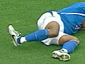 Soccer Player Snaps Leg