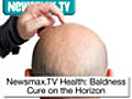 Newsmax.TV Health Report: Baldness Cure on the Horizon