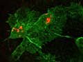 In Vivo Video: Immune Cells Munch on Bad Bacteria