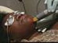Go! New York Report: Laser Facial Hair Removal