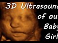 3D Ultrasound Baby Scan at 31 weeks