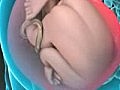 3D Medical Animation Cesarean Birth (C-section)