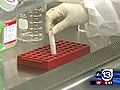 Stem cells used to repair heart damage