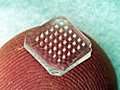 Microneedles may make getting flu shots easier