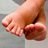 Why Diabetes Patients Must Check Feet