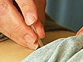 Clinic Cringe: Woman Trapped After Acupuncture