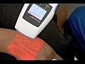 AccuVein AV300 Helps Healthcare Professionals Locate Hard...