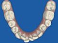 film occlusal mandibulaire