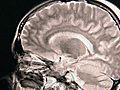 Latest : Brain study : CTV National News: Avis Favaro on the study