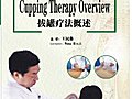 Traditional Chinese Medicine Cures All Diseases-Cupping Therapy Overview