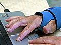 Carpal Tunnel Syndrome