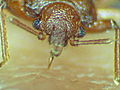 Infested!: Extreme Bedbug Infestation