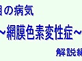 網膜色素変性症　【解説編】