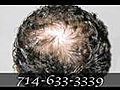 Men’s Hair Replacement Orange County