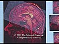 The Musical Brain 2009 (Documentary).avi